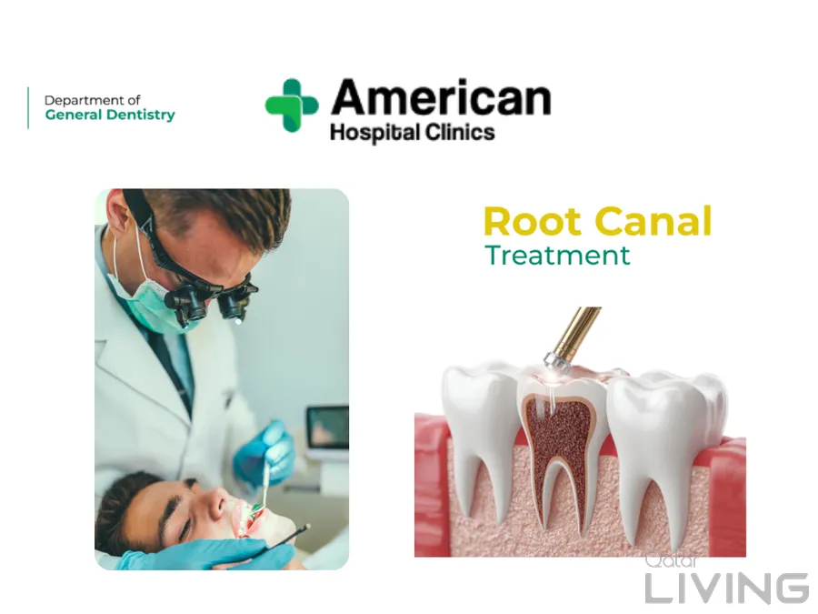 Root Canal Treatment - 499 QAR